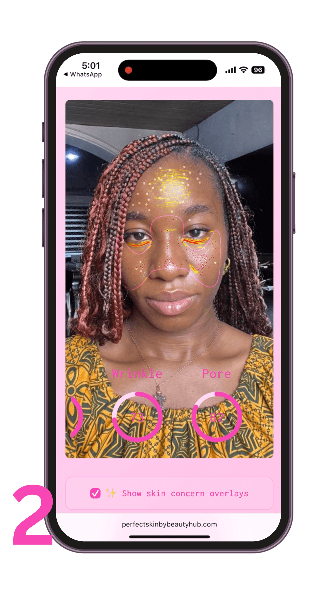 Step 2 - Skin Analysis